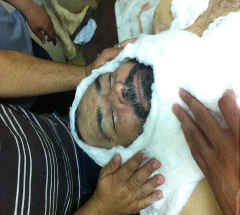 حمدى محمد