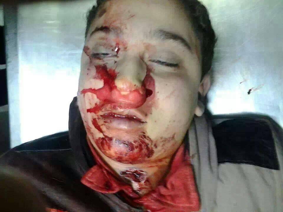 أسامة علي عبد العاطي - قتيل