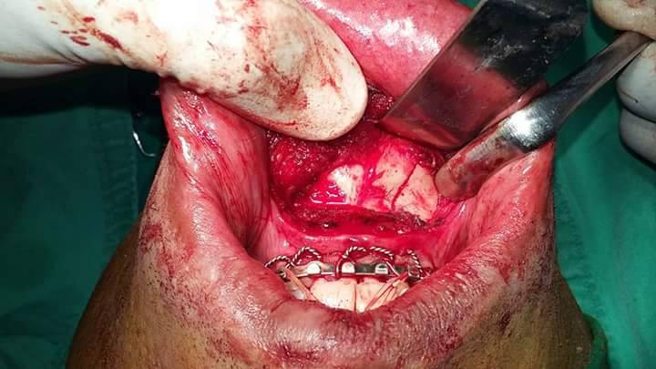 خالد أبو فاطمة1